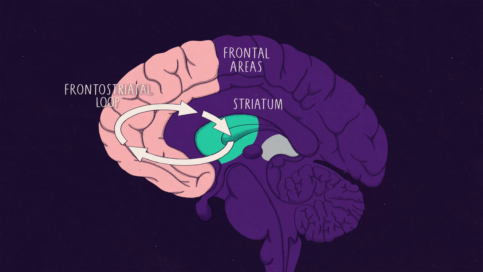A brain with frontal areas and the striatum highlighted in different colours, with arrows between them depicting frontostriatal loops.